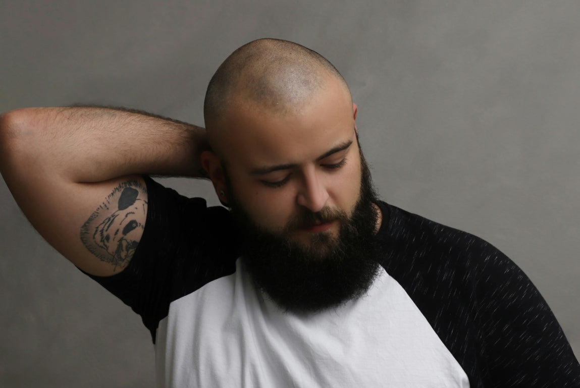 Testosterone and Hair Loss: What Science (and Your Scalp) Says