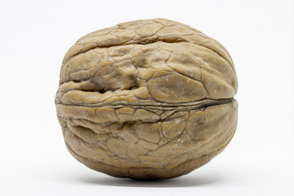 Prostate
