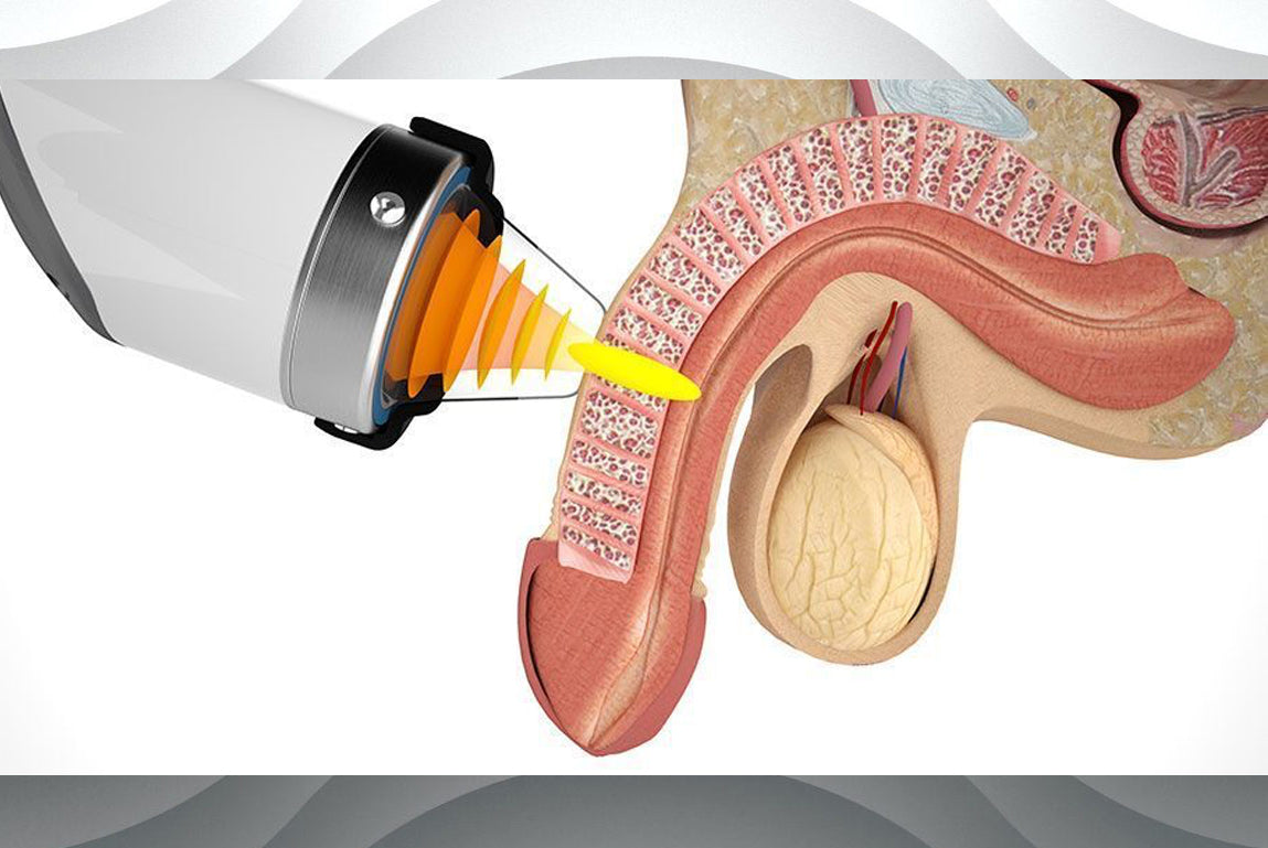 Jumpstart your junk! The latest therapy for Erectile Dysfunction